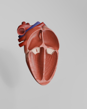 Atrial Septal Defect Pre-Operation Model